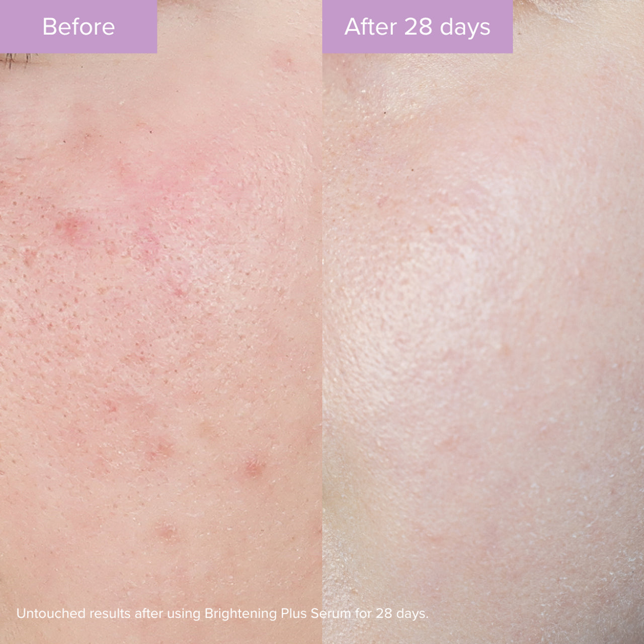 Brıghtenıng Plus Serum