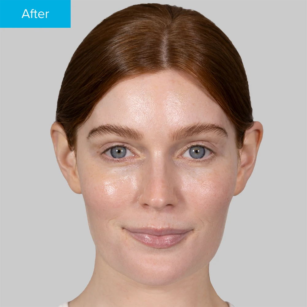 Hyaluronic Acid Serum - Nemlendirici Bakım Serumu 30ml