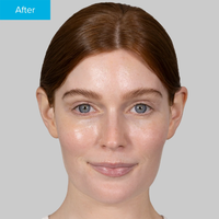 Hyaluronic Acid Serum - Nemlendirici Bakım Serumu 30ml