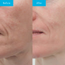 Niacinamide Ultra 5 Serum - Kırışıklık ve Gözenek Karşıtı Bakım Serumu 30ml