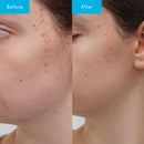 Niacinamide Ultra 5 Serum - Kırışıklık ve Gözenek Karşıtı Bakım Serumu 30ml