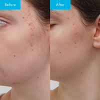 Niacinamide Ultra 5 Serum - Kırışıklık ve Gözenek Karşıtı Bakım Serumu 30ml